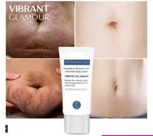 Vibrant Glamour Stretch Mark Cream